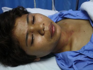 Mhaiwadee Thonglor, 24, in Mission Hospital this afternoon