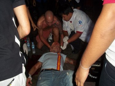 An Italian man lies injured in Patong after an assault early today