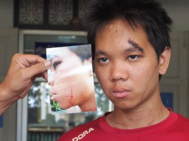 Chalermporn Kaewmanee, 20, alleges police brutality and corruption