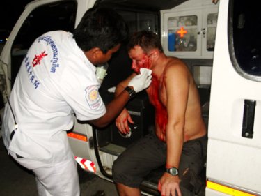 A Thai man has his face repaired after an altercation in Patong last night