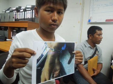 Prapakorn Waharak, 20, alleges he was beaten up by Phuket police