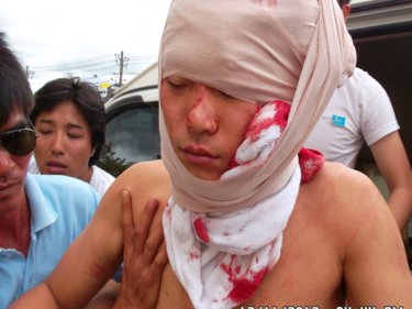Slashed Korean tourist Chulgue Kang lapsed into a coma yesterday