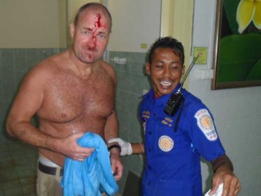 Danishman Jimy the worse for wear after an altercation in Patong today