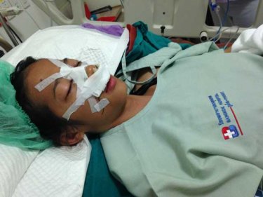Jen Khamsorn, reported to be in pain after today's operation on her face