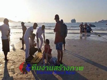 The Chinese tourist with the broken leg is treated at Patong beach tonight
