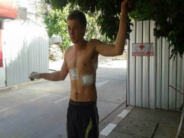 The young Australian shows his wounds after an alleged attack