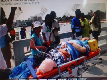 A man lost his leg in a horrific speedboat crash off Pattaya today