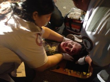 A paramedic helps the motorcycle rider injured in tonight's Phuket smash
