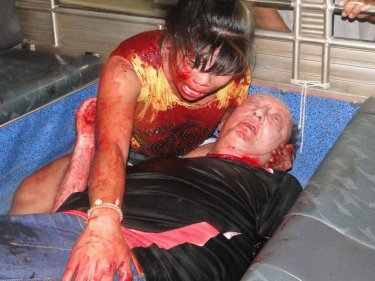 The bloodied couple after today's stabbing at their Patong apartment