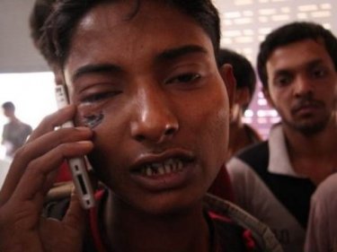 A man who was beaten by smugglers talks to family north of Phuket