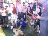 Aussie Tourist, Schoolboy Stabbed With Broken Bottles in Patong Fight