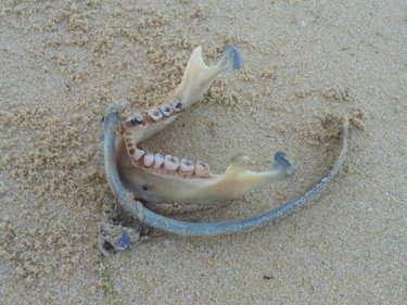 The jawbone found on Phuket's Surin beach, close to the body