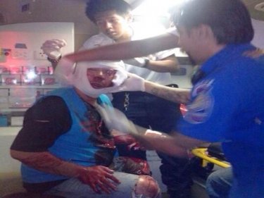 The badly cut motorcycle taxi rider is treated in Patong last night