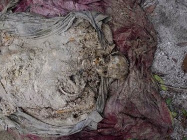 The remains of a pregnant woman after being removed from a grave