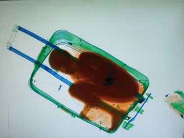 The scanned image of an eight-year-old boy inside a suitcase